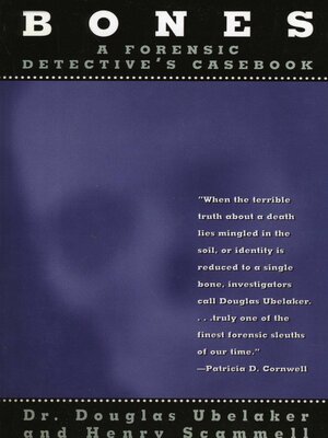 cover image of Bones